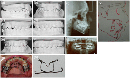 Figure 15.