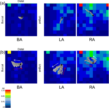 Figure 11.