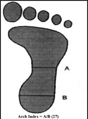 Figure 2: Measurement of arch index