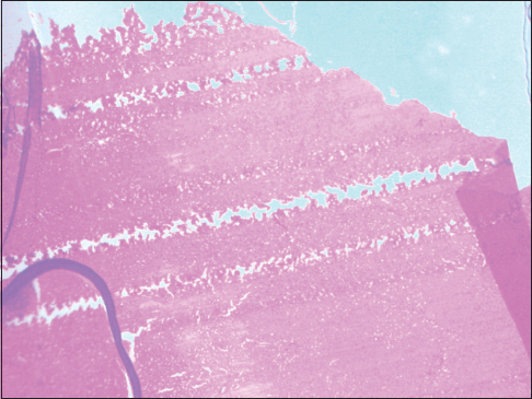 Figure 4: Scratch lines in a section of the liver, ×40