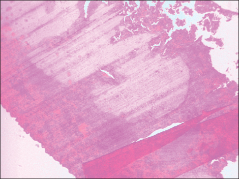 Figure 5: Knife lines and fold artifact in a section of the spleen, ×40