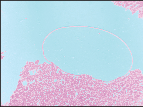 Figure 7: Air bubble entrapment in a section of the kidney, ×40