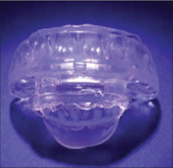 Figure 2: Snore guard