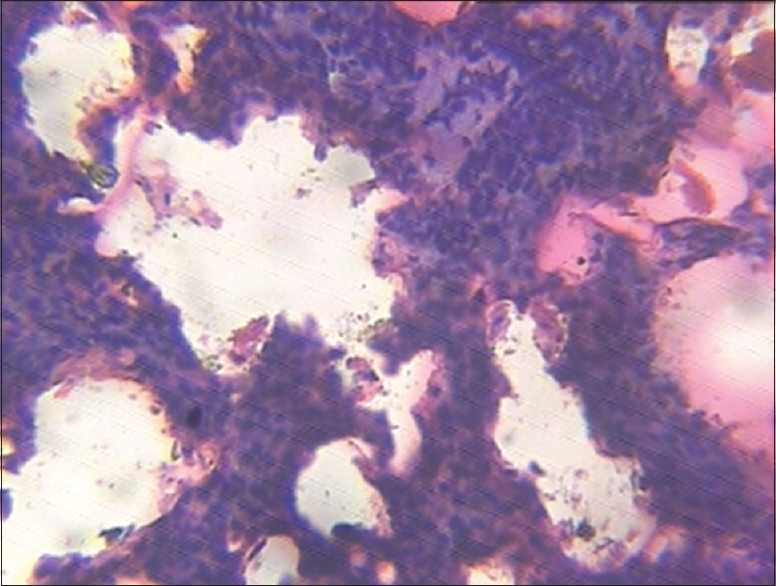 Figure 10: Lungs (1250 mg/kg of monosodium glutamate)