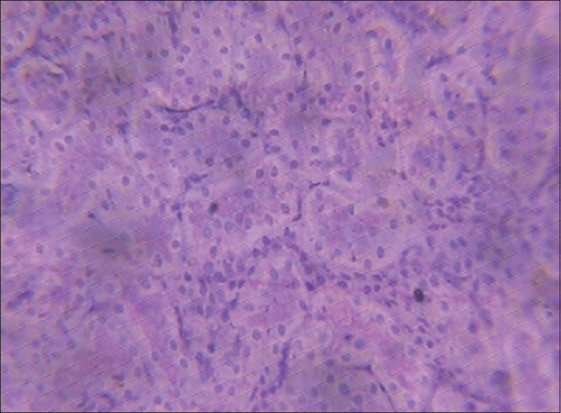 Figure 12: Kidney (1250 mg/kg of monosodium glutamate)