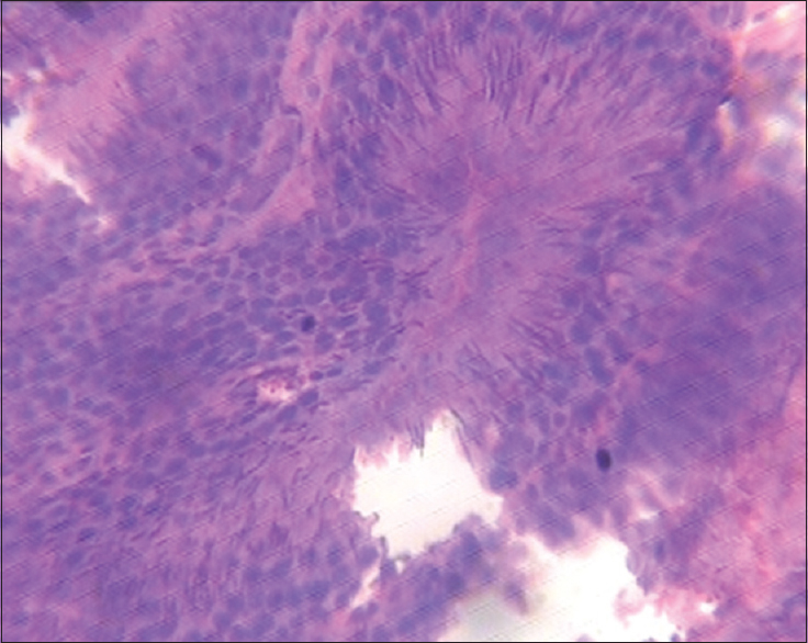 Figure 2: Testis (1000 mg/kg of monosodium glutamate)