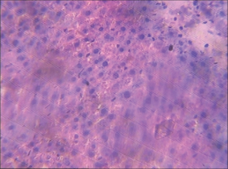 Figure 4: Liver (1000 mg/kg of monosodium glutamate)