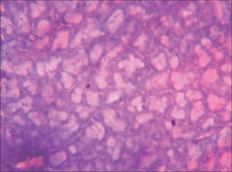 Figure 6: Spleen (1000 mg/kg of monosodium glutamate)