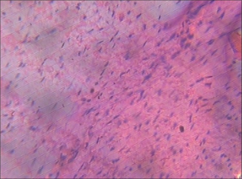 Figure 7: Heart (control group)