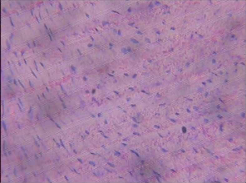 Figure 8: Heart (1250 mg/kg of monosodium glutamate)
