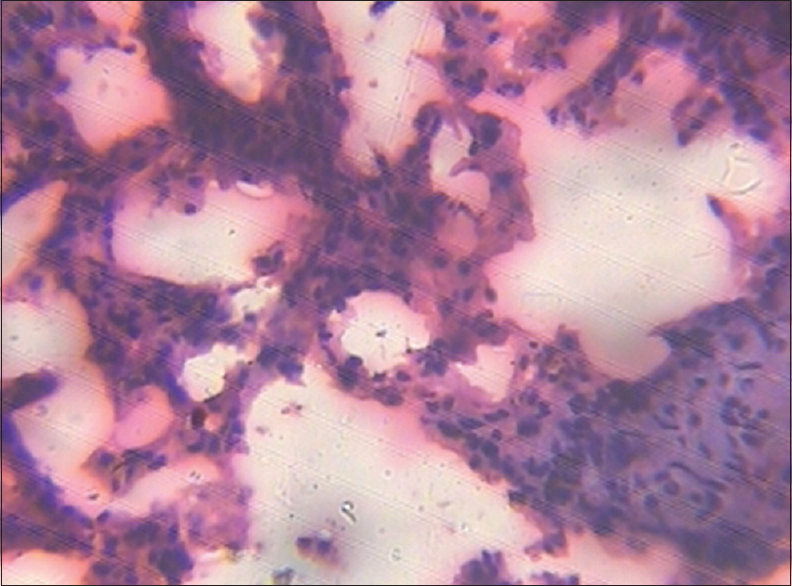 Figure 9: Lungs (control group)
