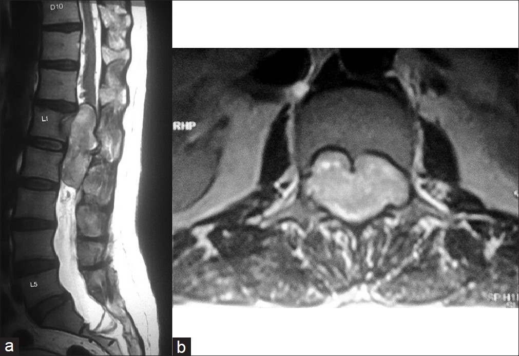 Figure 2: T2W axial image