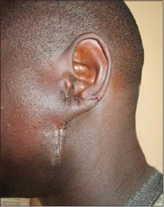 Figure 6: Post-operative result