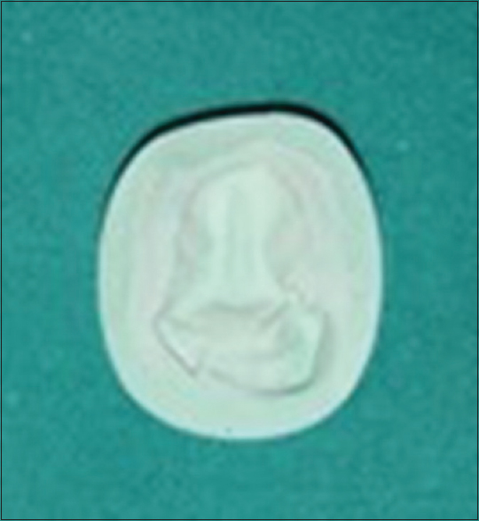 Figure 8: Master cast